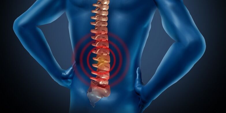 Lomber bölgenin osteokondrozu
